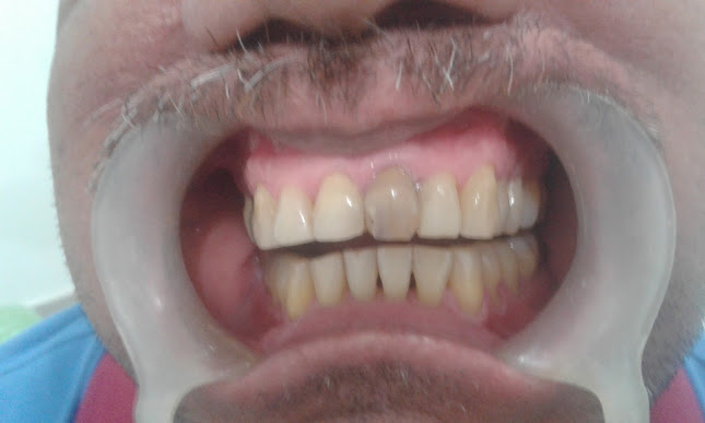 Cra. 11 #7-08, Comuna 3, Santa Marta, Magdalena